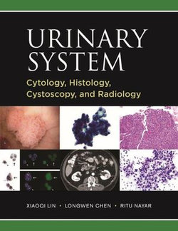 Urinary System: Cytology, Histology, Cystoscopy, and Radiology Urinary System: Cytology, Histology, Cystoscopy, and Radiology