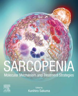 Sarcopenia Sarcopenia