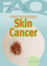 Frequently Asked Questions About Skin Cancer