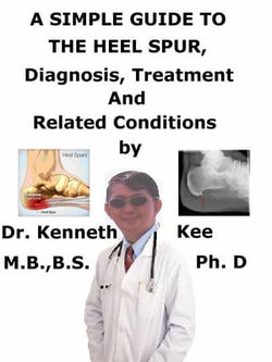 A Simple Guide to the Heel Spur, Diagnosis, Treatment and Related Conditions