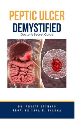 Peptic Ulcer Demystified: Doctor's Secret Guide Peptic Ulcer Demystified: Doctor's Secret Guide