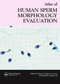 Atlas of Human Sperm Morphology Evaluation