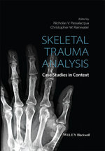 Skeletal Trauma Analysis