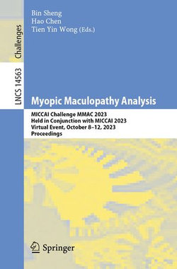 Myopic Maculopathy Analysis