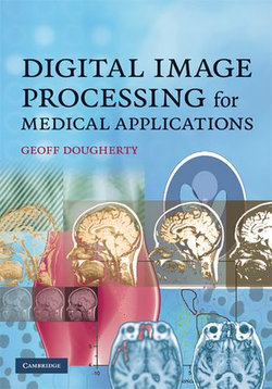 Digital Image Processing for Medical Applications Digital Image Processing for Medical Applications