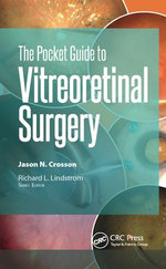 The Pocket Guide to Vitreoretinal Surgery
