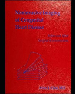 Noninvasive imaging of congenital heart disease