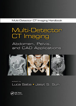 Multi-Detector CT Imaging