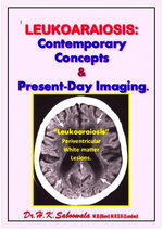 LEUKOARAIOSIS: Contemporary Concepts and Present-Day Imaging.