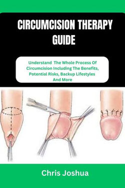 CIRCUMCISION THERAPY GUIDE