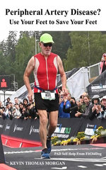 Peripheral Artery Disease? Use Your Feet to Save Your Feet
