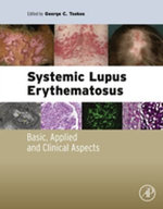 Systemic Lupus Erythematosus