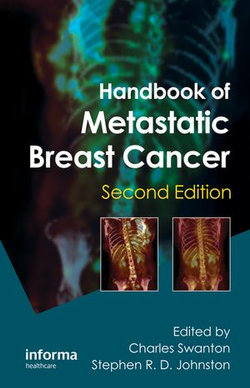 Handbook of Metastatic Breast Cancer Handbook of Metastatic Breast Cancer
