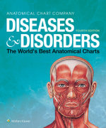 Diseases and Disorders