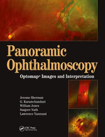 Panoramic Ophthalmoscopy