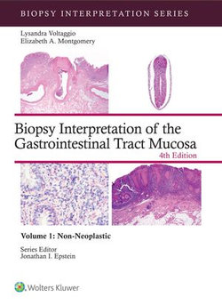 Biopsy Interpretation of the Gastrointestinal Tract Mucosa Volume 1 Biopsy Interpretation of the Gastrointestinal Tract Mucosa Volume 1