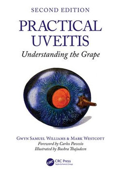 Practical Uveitis