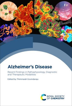 Alzheimer's Disease Alzheimer's Disease