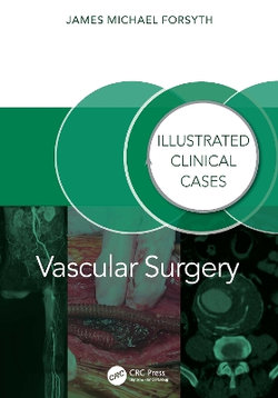 Vascular Surgery: Vascular Surgery:
