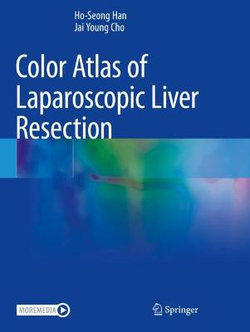 Color Atlas of Laparoscopic Liver Resection
