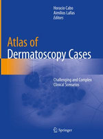 Atlas of Dermatoscopy Cases