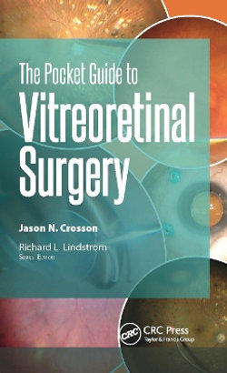 The Pocket Guide to Vitreoretinal Surgery