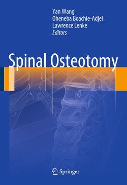 Spinal Osteotomy
