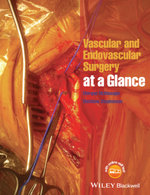 Vascular and Endovascular Surgery at a Glance