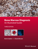 Bone Marrow Diagnosis