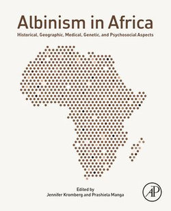 Albinism in Africa