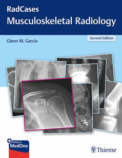 RadCases Q&a Musculoskeletal Radiology