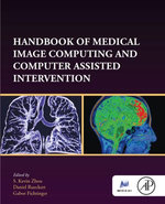 Handbook of Medical Image Computing and Computer Assisted Intervention