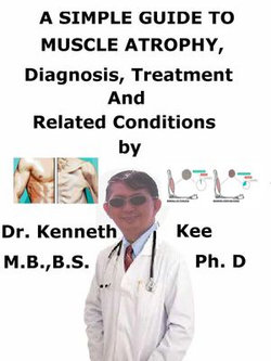 A Simple Guide to Muscle Atrophy, Diagnosis, Treatment and Related Conditions