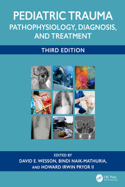 Pediatric Trauma