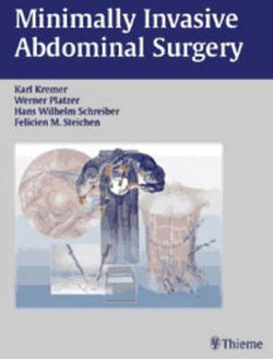 Minimally Invasive Abdominal Surgery Minimally Invasive Abdominal Surgery