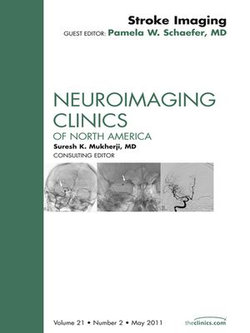 Stroke Imaging Update, An Issue of Neuroimaging Clinics