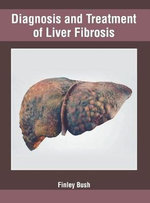 Diagnosis and Treatment of Liver Fibrosis Diagnosis and Treatment of Liver Fibrosis