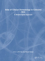 Atlas of Clinical Dermatology in Coloured Skin