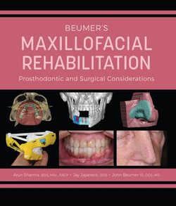 Beumer's Maxillofacial Rehabilitation