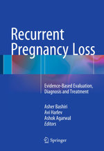 Recurrent Pregnancy Loss