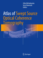 Atlas of Swept Source Optical Coherence Tomography