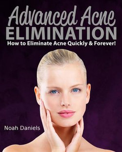 Advanced Acne Elimination Advanced Acne Elimination