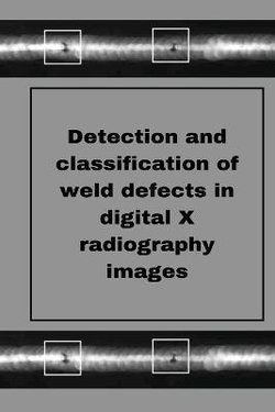 Perception of weld defects in digital X radiography images