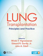 Lung Transplantation Lung Transplantation