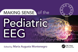 Making Sense of the Pediatric EEG Making Sense of the Pediatric EEG