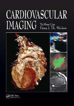 Cardiovascular Imaging