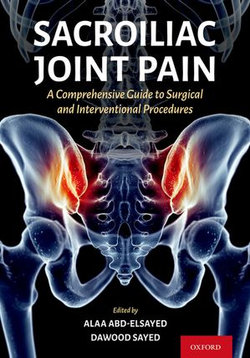 Sacroiliac Joint Pain Sacroiliac Joint Pain