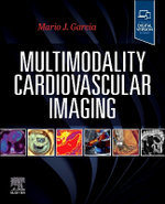 Multimodality Cardiovascular Imaging Multimodality Cardiovascular Imaging