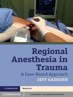 Regional Anesthesia in Trauma Regional Anesthesia in Trauma