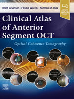 Clinical Atlas of Anterior Segment OCT: Ocular Coherence Tomography - E-Book
